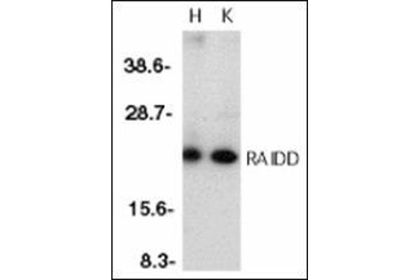 CRADD antibody  (Middle Region)