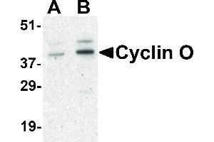 Image no. 1 for anti-Cyclin O (CCNO) (Internal Region) antibody (ABIN6656847)