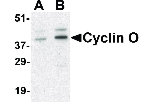 anti-Cyclin O (CCNO) (Internal Region) antibody
