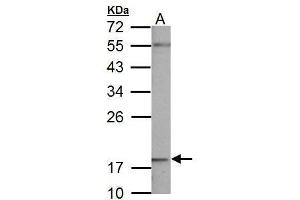 anti-NADH Dehydrogenase (Ubiquinone) 1 beta Subcomplex, 5, 16kDa (NDUFB5) (C-Term) antibody