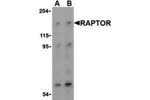 Western Blotting (WB) image for anti-RAPTOR (RAPTOR) (Middle Region) antibody (ABIN1031053)