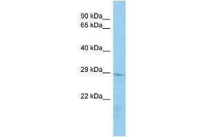 Image no. 1 for anti-Transmembrane Protein 178A (TMEM178A) (N-Term) antibody (ABIN2775639)