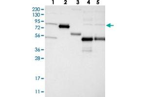 Image no. 1 for anti-Glycosyltransferase 25 Domain Containing 2 (GLT25D2) antibody (ABIN5578875)