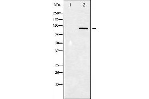 Image no. 2 for anti-Signal Transducer and Activator of Transcription 3 (Acute-Phase Response Factor) (STAT3) (pTyr705) antibody (ABIN6255995)
