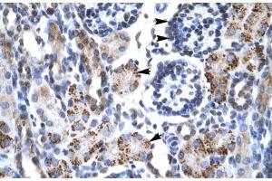 Rabbit Anti-GFI1B Antibody Catalog Number: ARP30093 Paraffin Embedded Tissue: Human Kidney Cellular Data: Epithelial cells of renal tubule and renal corpuscle Antibody Concentration: 4.