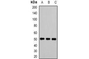 Image no. 1 for anti-Vaccinia Related Kinase 1 (VRK1) (full length) antibody (ABIN6006256)