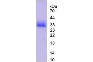 Image no. 1 for Cyclin-Dependent Kinase 1 (CDK1) (AA 13-297) protein (His tag) (ABIN1099003)
