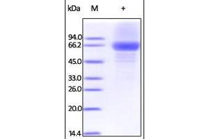 Image no. 1 for Interleukin 12 alpha (IL12A) (AA 23-219) protein (Fc Tag) (ABIN2181329)