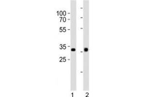 Image no. 2 for anti-Orthodenticle Homeobox 2 (OTX2) (C-Term) antibody (ABIN3028907)