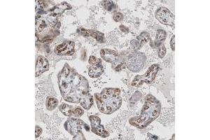 Immunohistochemical staining (Formalin-fixed paraffin-embedded sections) of human placenta shows strong immunoreactivity in endothelial cells.