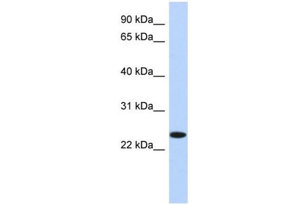 NKAIN4 antibody  (N-Term)