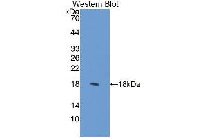 Image no. 1 for anti-Regulator of Chromosome Condensation (RCC1) and BTB (POZ) Domain Containing Protein 2 (RCBTB2) (AA 394-519) antibody (ABIN1870265)