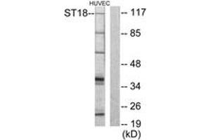 Image no. 1 for anti-Zinc Finger Protein 387 (ZNF387) (AA 41-90) antibody (ABIN1533516)