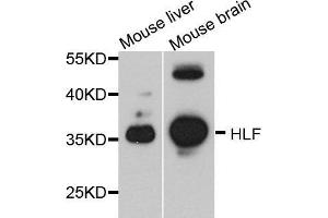 Western blot analysis of extracts of various cell lines, using HLF antibody.