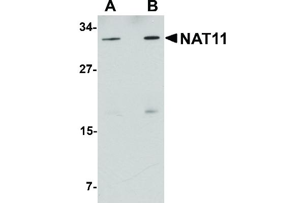 NAA40 anticorps  (C-Term)