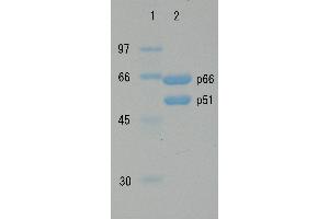 SDS-PAGE (SDS) image for HIV-1 Reverse Transcriptase (HIV1RT) (Active) protein (ABIN7233213)