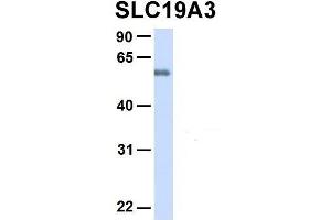 Image no. 4 for anti-Solute Carrier Family 19, Member 3 (Slc19a3) (Middle Region) antibody (ABIN2775519)