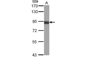 Image no. 1 for anti-Forkhead Box O3 (FOXO3) (C-Term) antibody (ABIN2854686)
