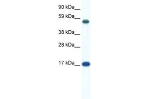 Image no. 1 for anti-Zinc Finger Protein 554 (ZNF554) antibody (ABIN2461304)