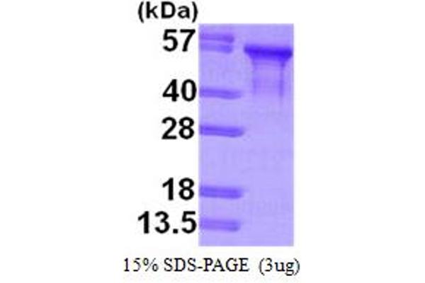 tau Protein (AA 1-381) (His tag)