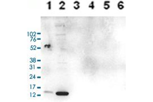 HIST1H3A Antikörper  (2meArg17 (asymetric), acLys18)