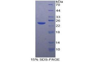 Image no. 1 for Tachykinin Receptor 2 (TACR2) (AA 92-290) protein (His tag) (ABIN1878534)