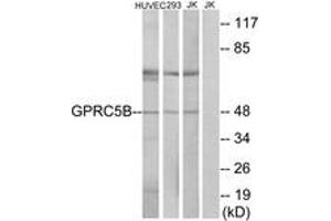 Image no. 1 for anti-G Protein-Coupled Receptor, Family C, Group 5, Member B (GPRC5B) (AA 61-110) antibody (ABIN1535728)