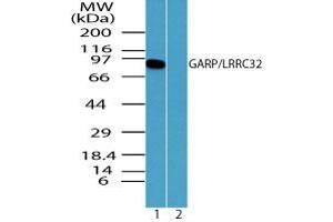 Image no. 2 for anti-Leucine Rich Repeat Containing 32 (LRRC32) (AA 250-300) antibody (ABIN960252)