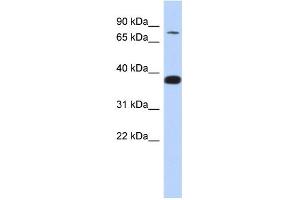 Image no. 1 for anti-Zinc Finger Protein 526 (ZNF526) (N-Term) antibody (ABIN2779477)