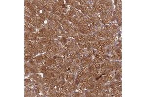 Image no. 2 for anti-PiggyBac Transposable Element Derived 4 (PGBD4) antibody (ABIN5585573)