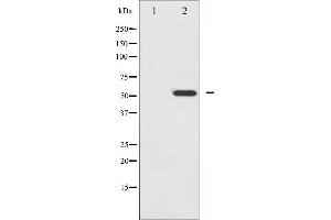 Image no. 4 for anti-Hepatocyte Nuclear Factor 4, alpha (HNF4A) (pSer313) antibody (ABIN6256265)