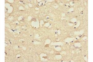 Immunohistochemistry of paraffin-embedded human brain tissue using ABIN7148475 at dilution of 1:100