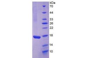 Image no. 1 for Interleukin 17 (IL17) protein (ABIN3010183)