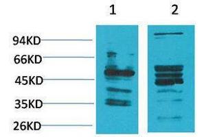 Image no. 1 for anti-Neuromedin B Receptor (NMBR) antibody (ABIN3181543)