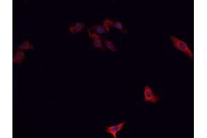 ABIN6266732 staining A-431 cells by IF/ICC.