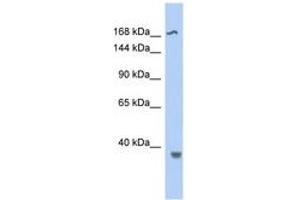 Image no. 1 for anti-Topoisomerase (DNA) II beta 180kDa (TOP2B) (AA 1439-1488) antibody (ABIN6742341)