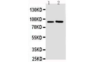 Image no. 1 for anti-Fibroblast Growth Factor Receptor 3 (FGFR3) (AA 110-129), (N-Term) antibody (ABIN3043988)