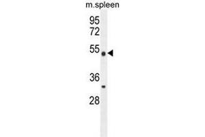 Image no. 3 for anti-Methyltransferase Like 4 (METTL4) (AA 322-352), (C-Term) antibody (ABIN953400)