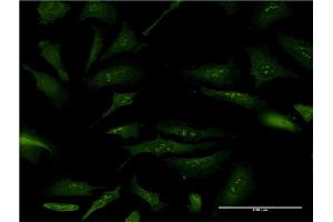 Immunofluorescence of monoclonal antibody to NPM2 on HeLa cell.