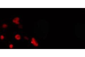 Image no. 1 for anti-Mesenchyme Homeobox 2 (MEOX2) antibody (ABIN6257271)