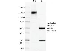 Image no. 6 for anti-Thrombomodulin (THBD) (AA 69-194) antibody (ABIN6940727)