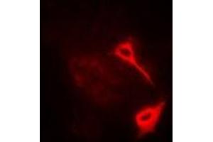 Image no. 1 for anti-Hyaluronan Synthase 3 (HAS3) antibody (ABIN2966704)
