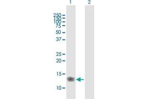 anti-Interferon-Induced Transmembrane Protein 3 (IFITM3) (AA 1-133) antibody