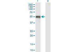 Image no. 1 for anti-3-Oxoacid CoA Transferase 1 (OXCT1) (AA 1-520) antibody (ABIN518562)