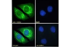 Image no. 4 for anti-TNF Receptor-Associated Factor 2 (TRAF2) (C-Term) antibody (ABIN190911)