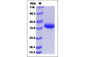 Image no. 1 for Secretoglobin, Family 3A, Member 1 (SCGB3A1) (AA 1-104) protein (Fc Tag) (ABIN2005693)