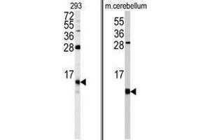 Image no. 1 for anti-FK506 Binding Protein 1B, 12.6 KDa (FKBP1B) (N-Term) antibody (ABIN453013)