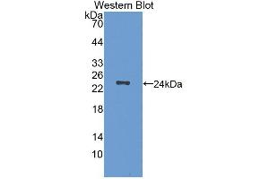 Image no. 1 for anti-Protein CutA (CUTA) (AA 33-179) antibody (ABIN1866503)