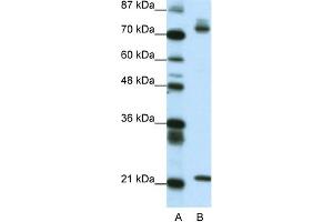 Image no. 1 for anti-SATB Homeobox 1 (SATB1) (C-Term) antibody (ABIN2777889)