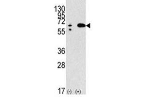 Image no. 1 for anti-Beclin 1, Autophagy Related (BECN1) (AA 210-239) antibody (ABIN3030156)